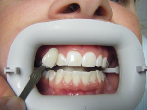 Case 5 Zoom After