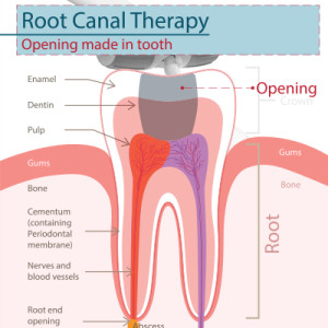 diagram of the anatomy of a root canal of a tooth